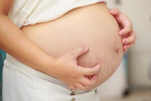 холестаз при беременности