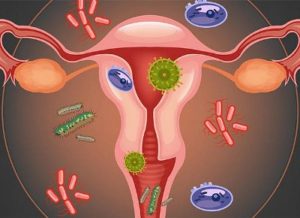 Эпидемиология бактериального вагиноза