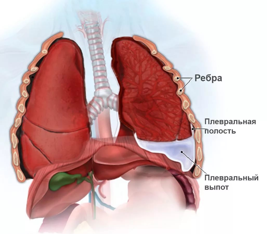 Плевральная полость картинки