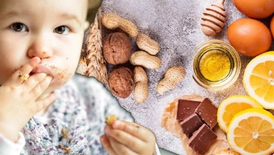 Аллергия у детей, пищевая