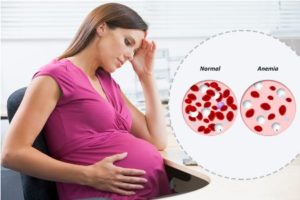 анемия при беременности